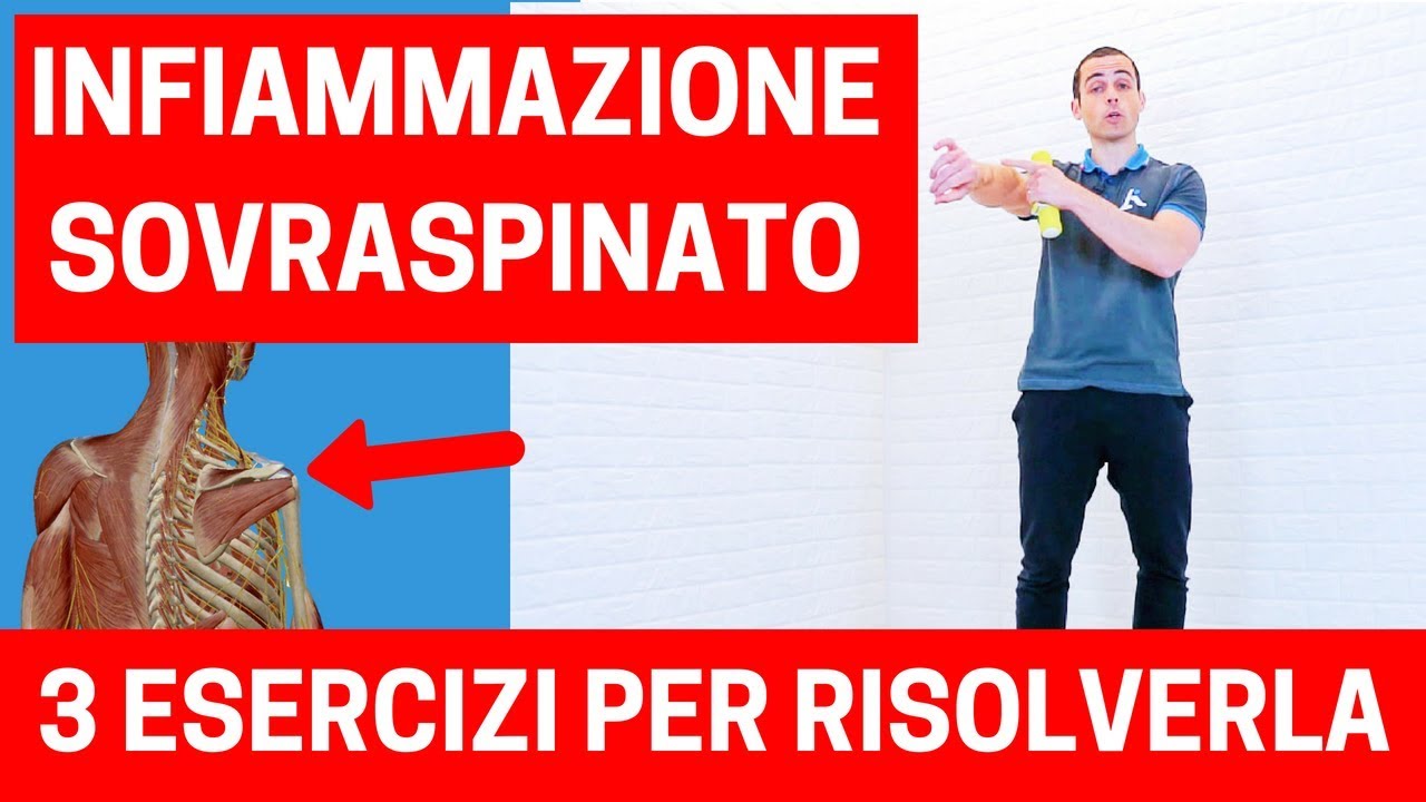 Infiammazione o lesione del sovraspinato: cosa fare (esercizi molto efficaci)