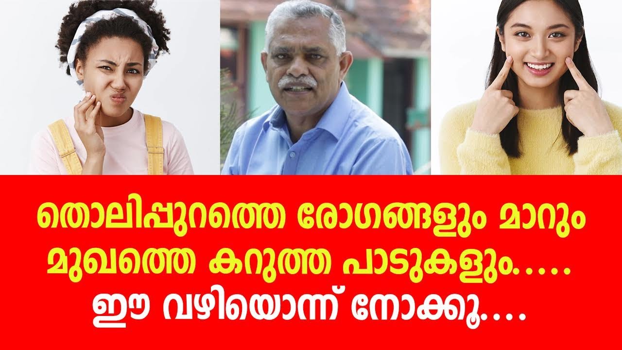 തൊലിപ്പുറത്തെ രോഗങ്ങളും മാറുംമുഖത്തെ കറുത്ത പാടുകളും...ഈ വഴിയൊന്ന് നോക്കൂ....