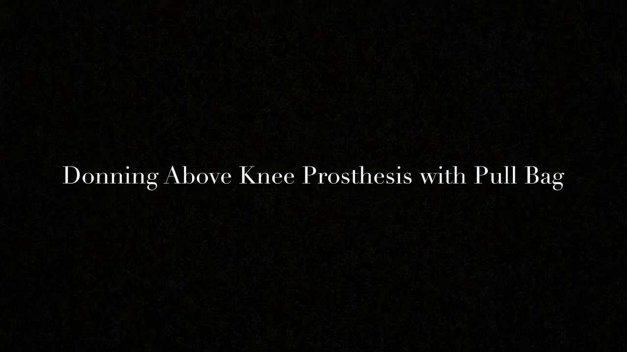 Donning an Above Knee Prosthesis with Pull Bag