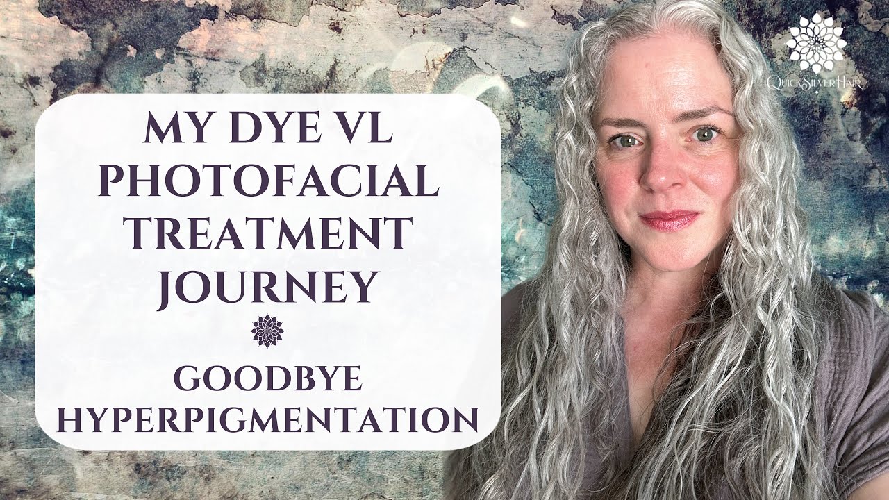 Мой опыт фототерапии Harmony XL Dye VL | Прощай, гиперпигментация | Джоли Кэмпбелл