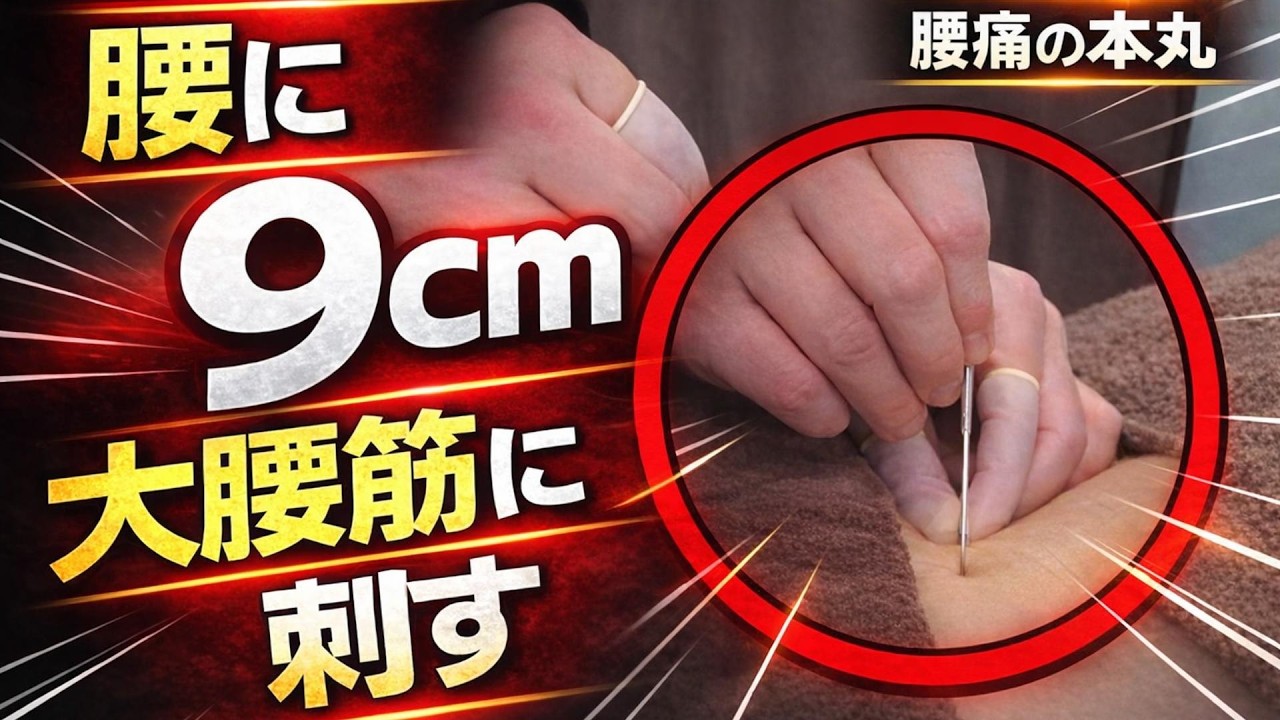 【腰に9cm】腰痛の本丸へ。大腰筋へ深層鍼