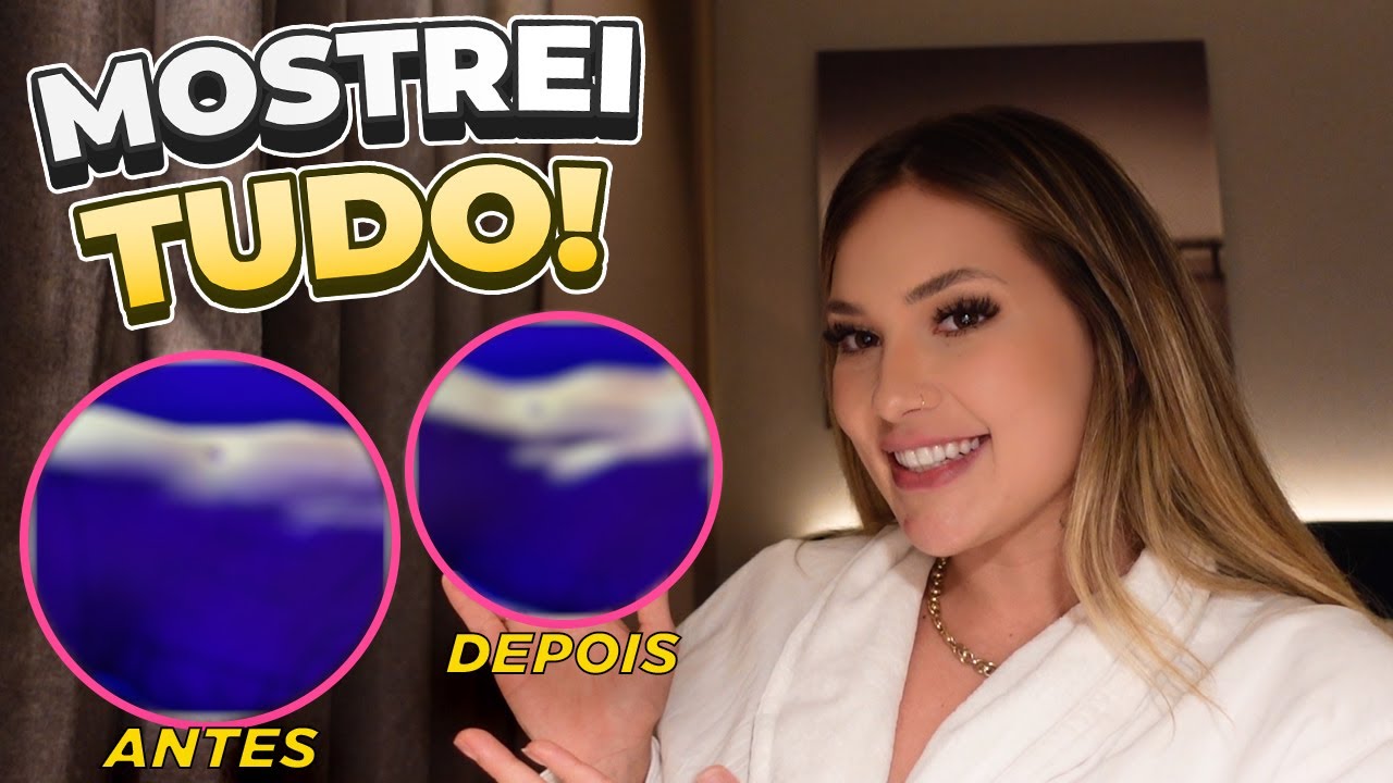 MINHA PRIMA FEZ UMA CIRURGIA E EU MOSTREI O ANTES/DEPOIS!!