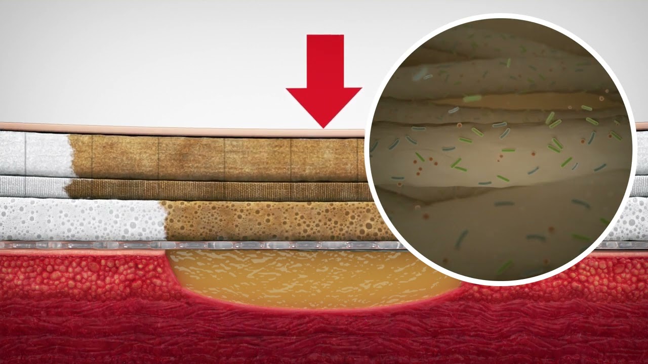 How it works Mepilex Border Flex?