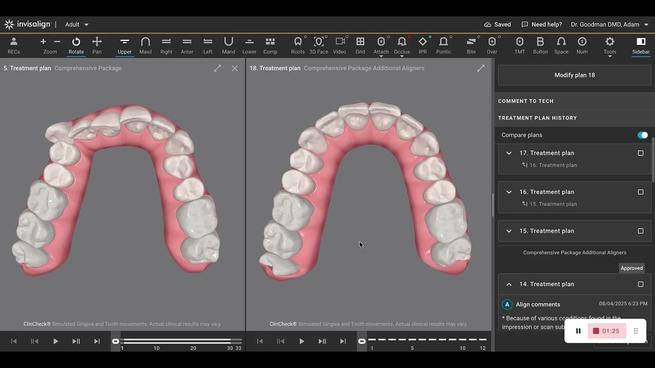 A Great Invisalign or Braces Result Can Still Be Short of Perfection