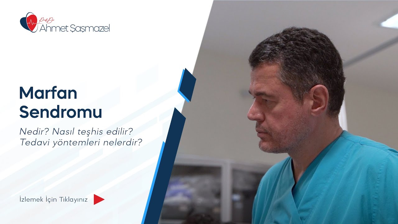 Marfan Sendromu Hakkında Merak Edilenler