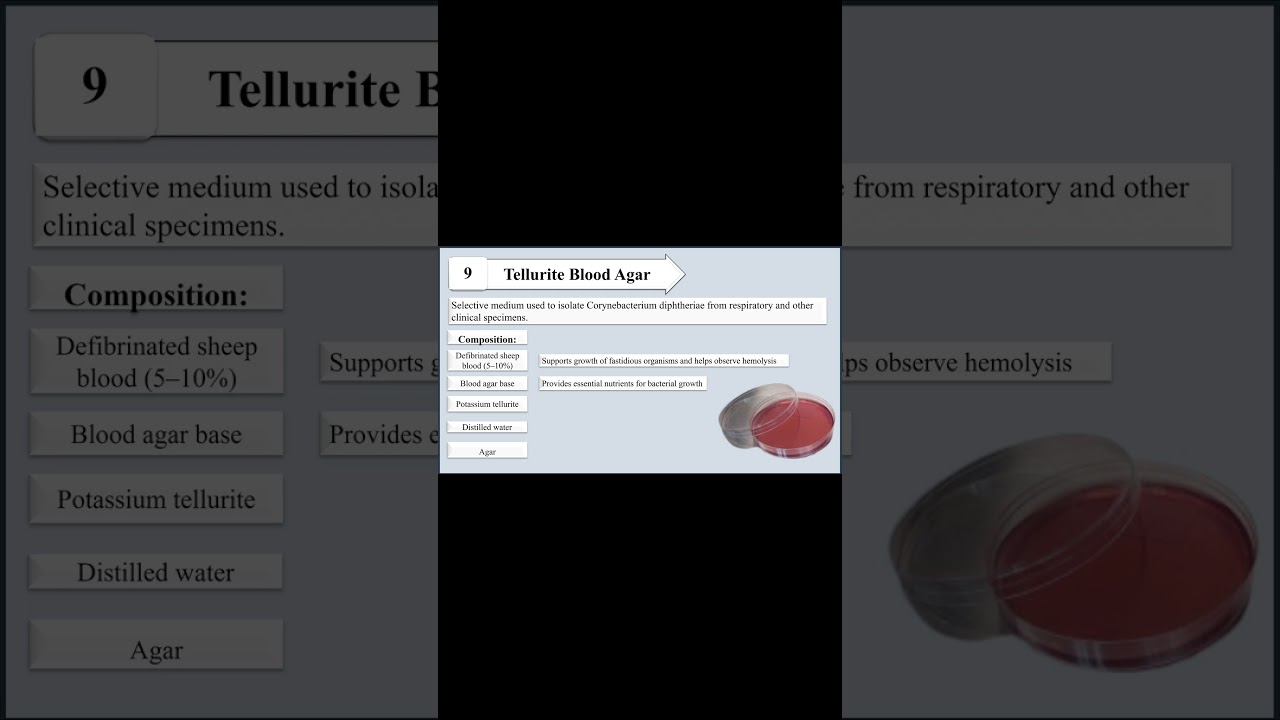 Tellurite Blood Agar I Purpose and Composition I Selective Media I Bacterial Culture Media I Microbe