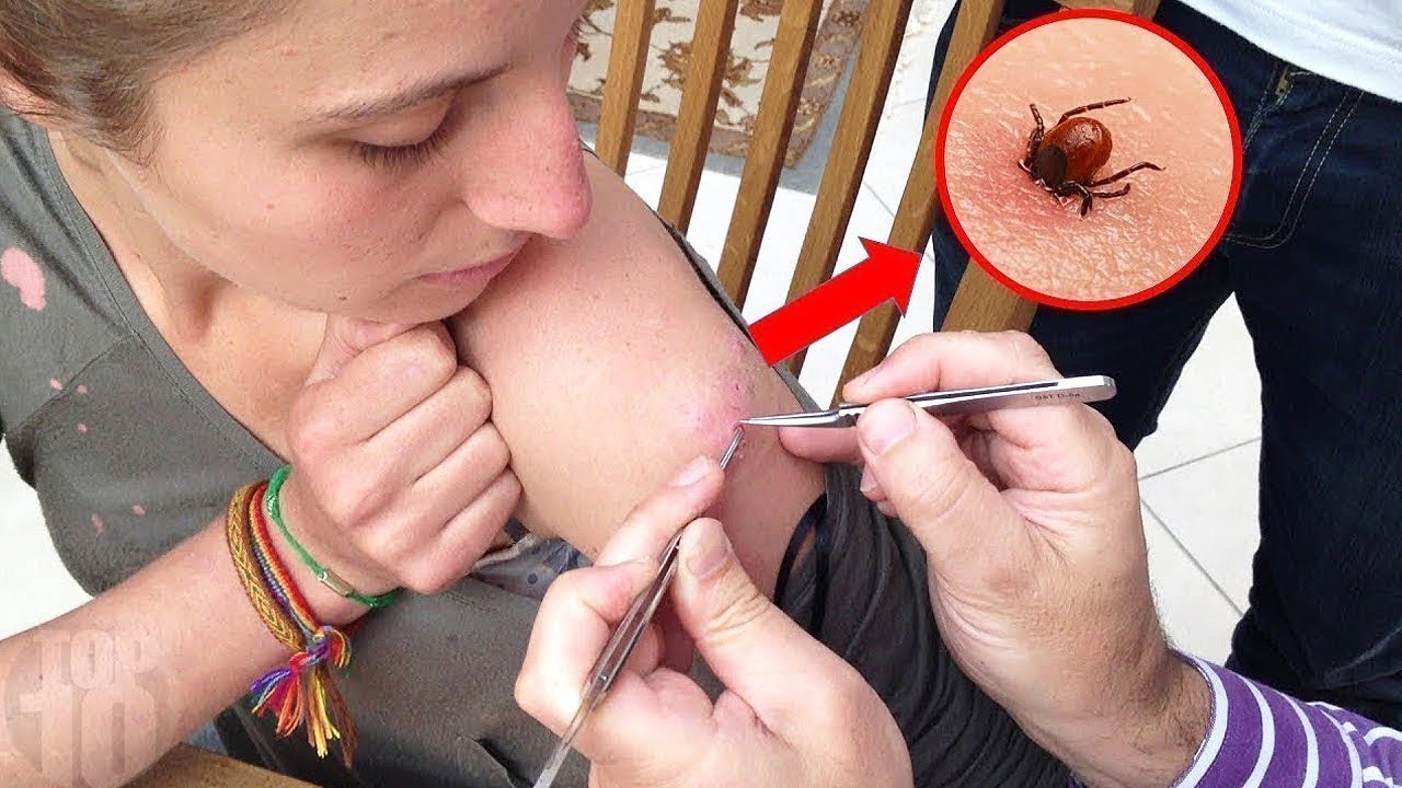 10 Scariest Insects On Earth