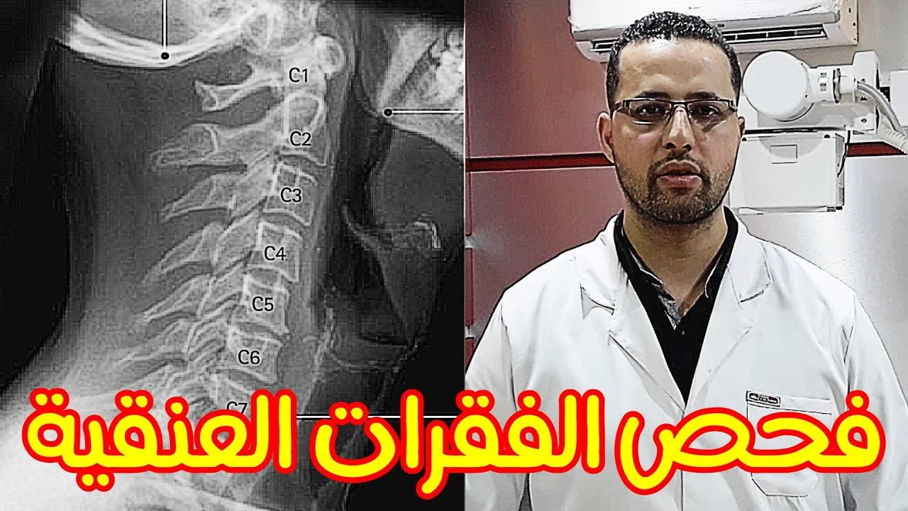 Cervical spine x ray تصوير الفقرات العنقيه بالاشعه  العاديه