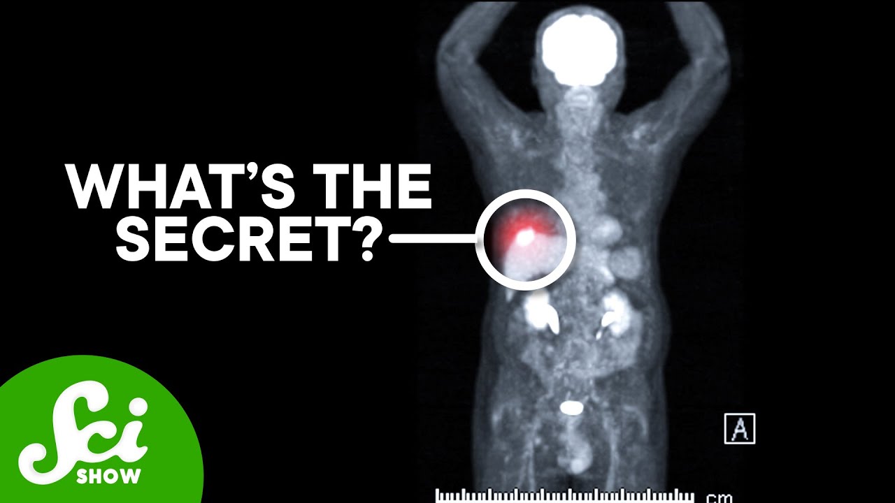How PET Scans See Cancer
