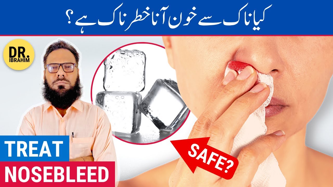 Nakseer Ka Ilaj - Nosebleed Causes & Treatment - Naak Se Khoon Aane Ki Wajah/Ilaj - Urdu/Hindi
