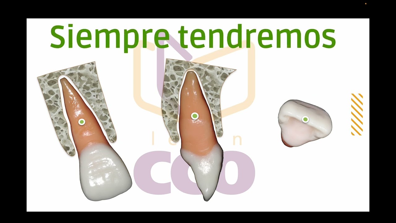 Comportamiento de los brackets convencionales