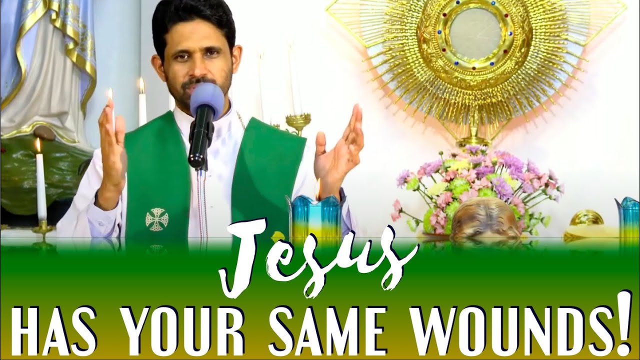 Fr Antony Parankimalil VC - Jesus has your same wounds!