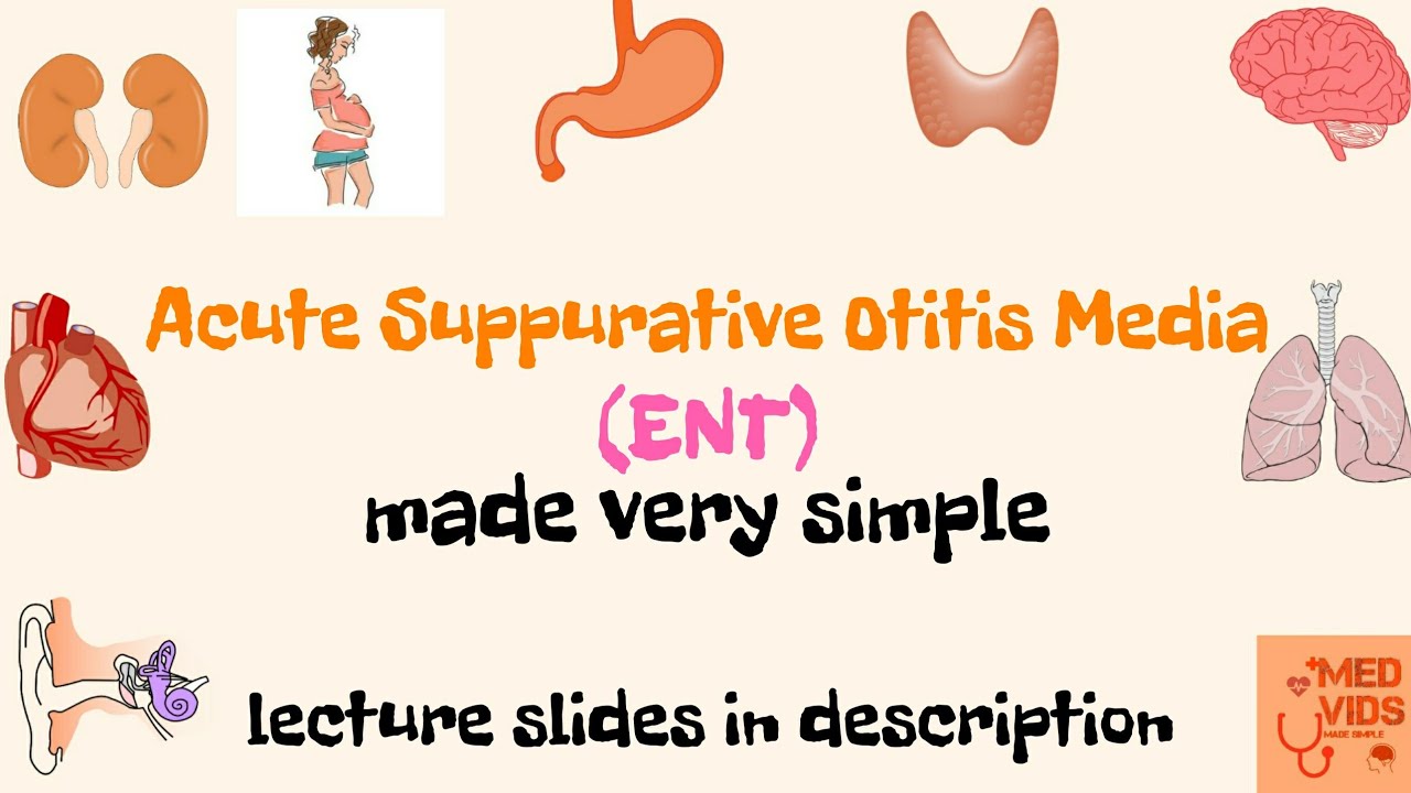 Acute Suppurative Otitis Media | ASOM | ENT | Med Vids made simple