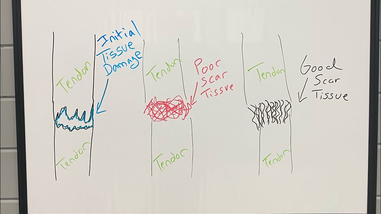 🔥 Scar Tissue Healing ❓❓