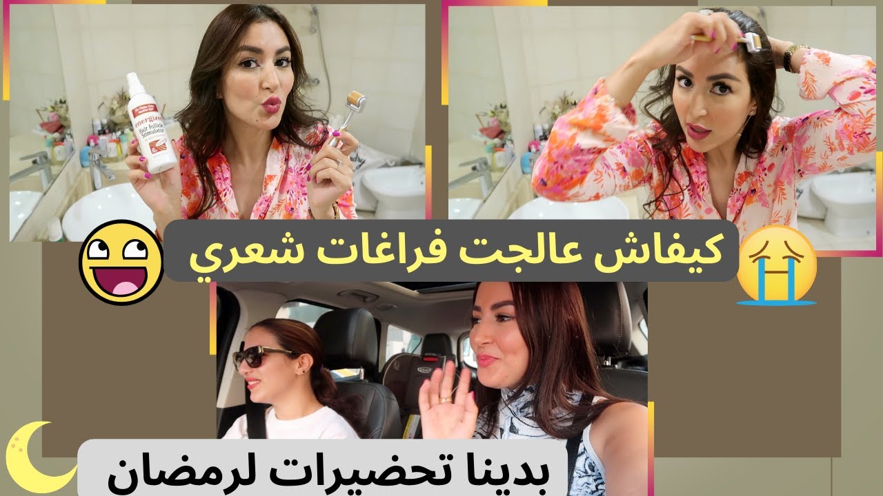 😱جميع اسراري🙊أسرع طريقة من أجل تكثيف و تطويل الشعر🤫 MY HAIR FALL REMEDIES🤯