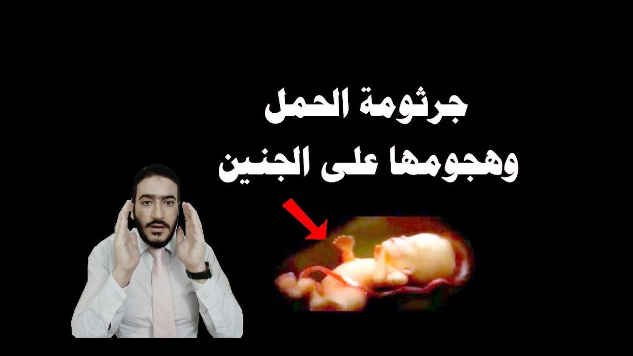 جرثومة الحمل وهجومها على الجنين وكيف نتقي شرها وتحمي نفسك وجنينك منها