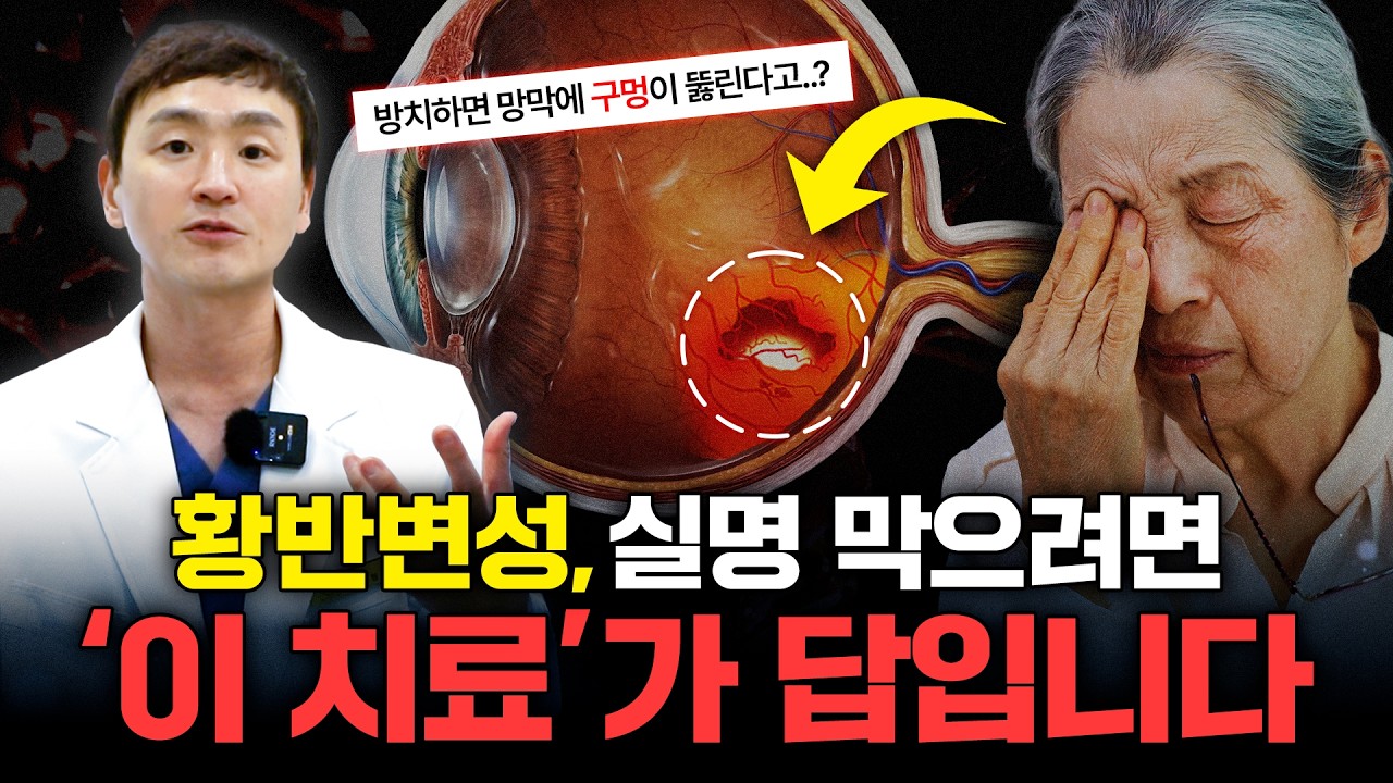 실명을 부르는 황반변성.. 의사가 말하는 유일한 치료법