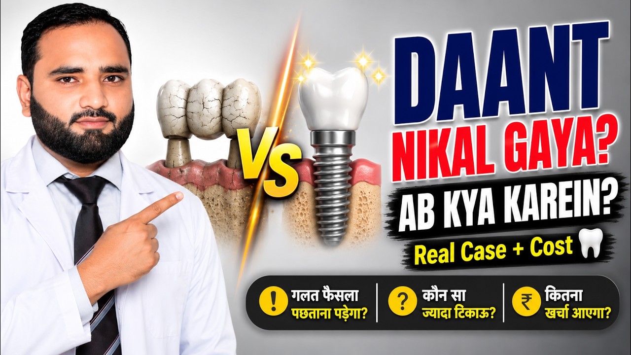 Dental Implant vs Bridge | Missing Tooth | Best Treatment | Dr Aqeel Maqsood