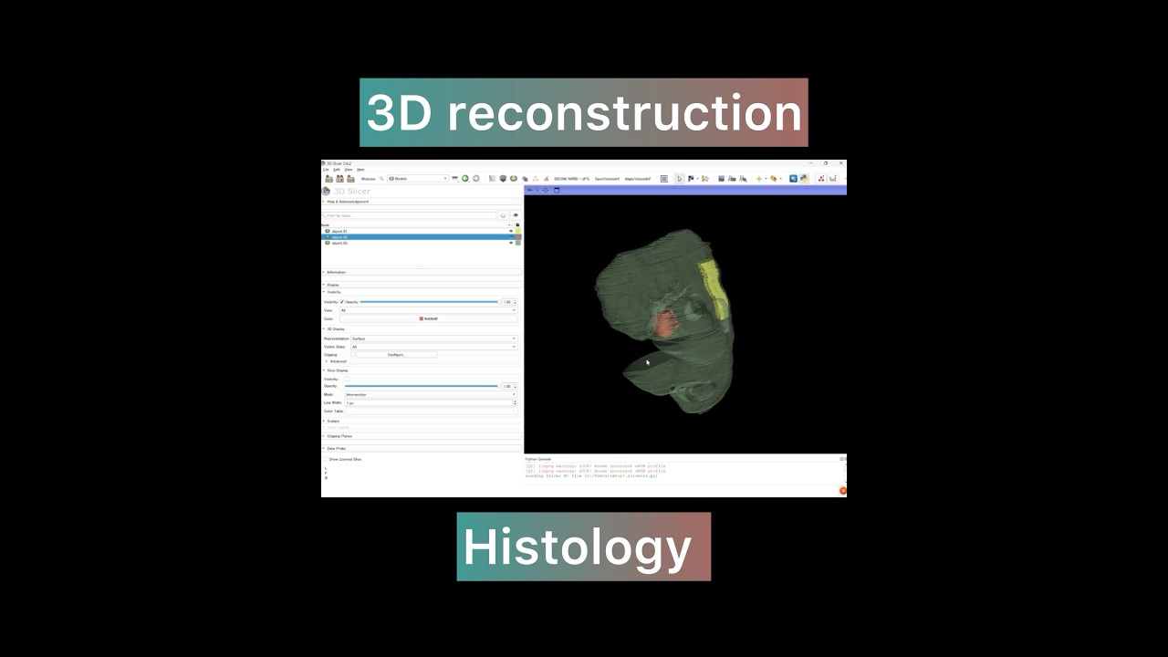 3D reconstruction Histology 連続組織切片から3D再構築