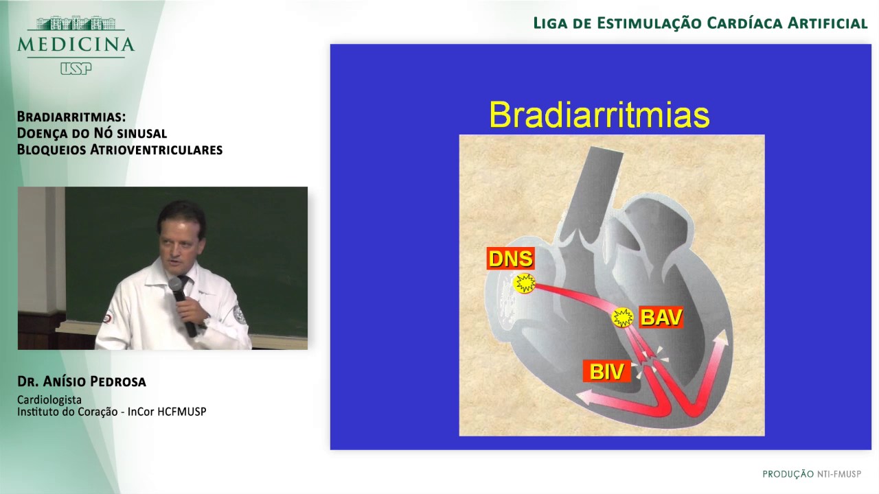 Bradiarritmias - Dr Anísio Pedrosa - FMUSP