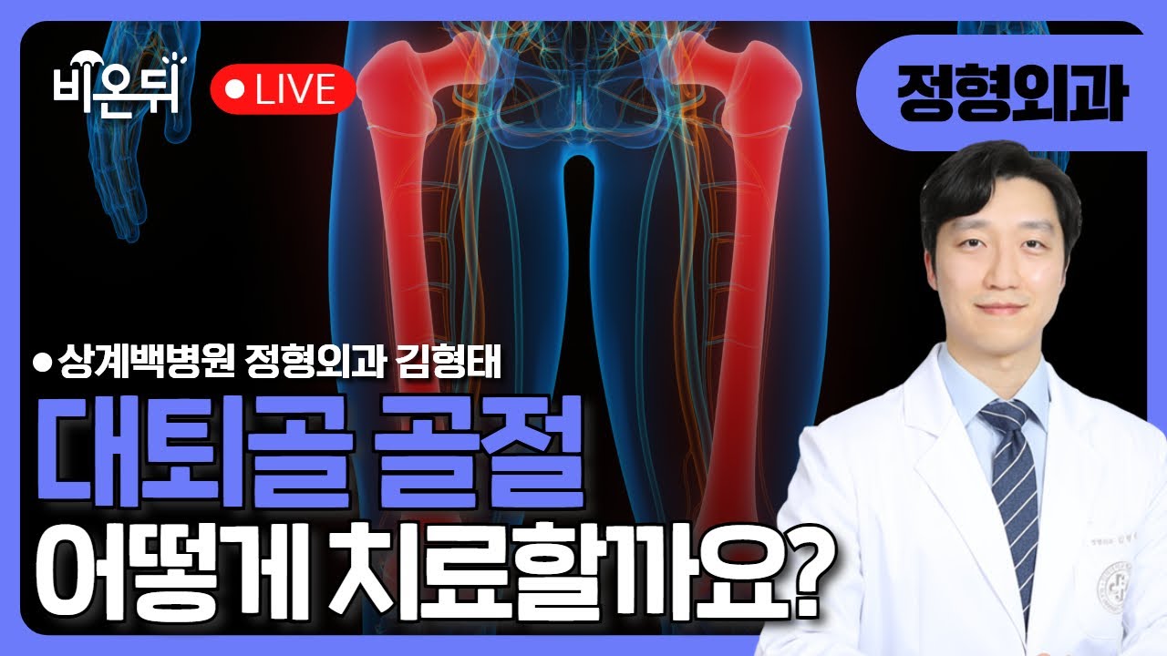대퇴골 골절 / 상계백병원 정형외과 김형태