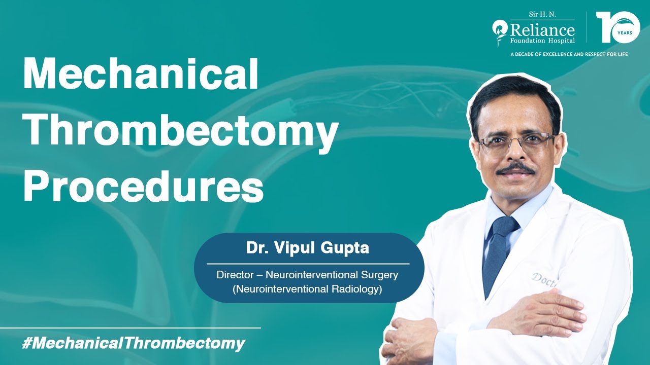 Mechanical Thrombectomy: A Game-Changer in Stroke Treatment I Dr. Vipul Gupta