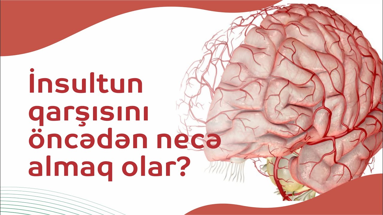 #Beyin qan dövranı pozğunluğu. İnsultun qarşısını öncədən necə almaq olar?