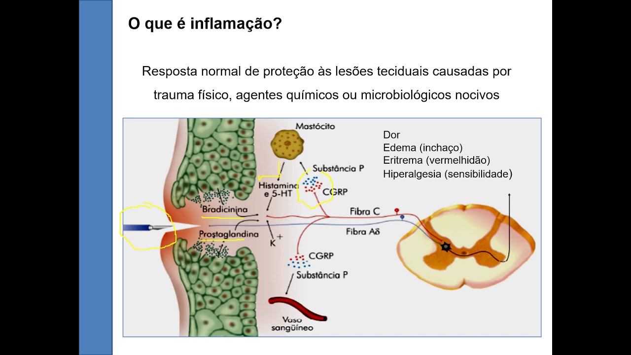 Video aula sobre Anti-inflamatórios não esteroidais (AINES)