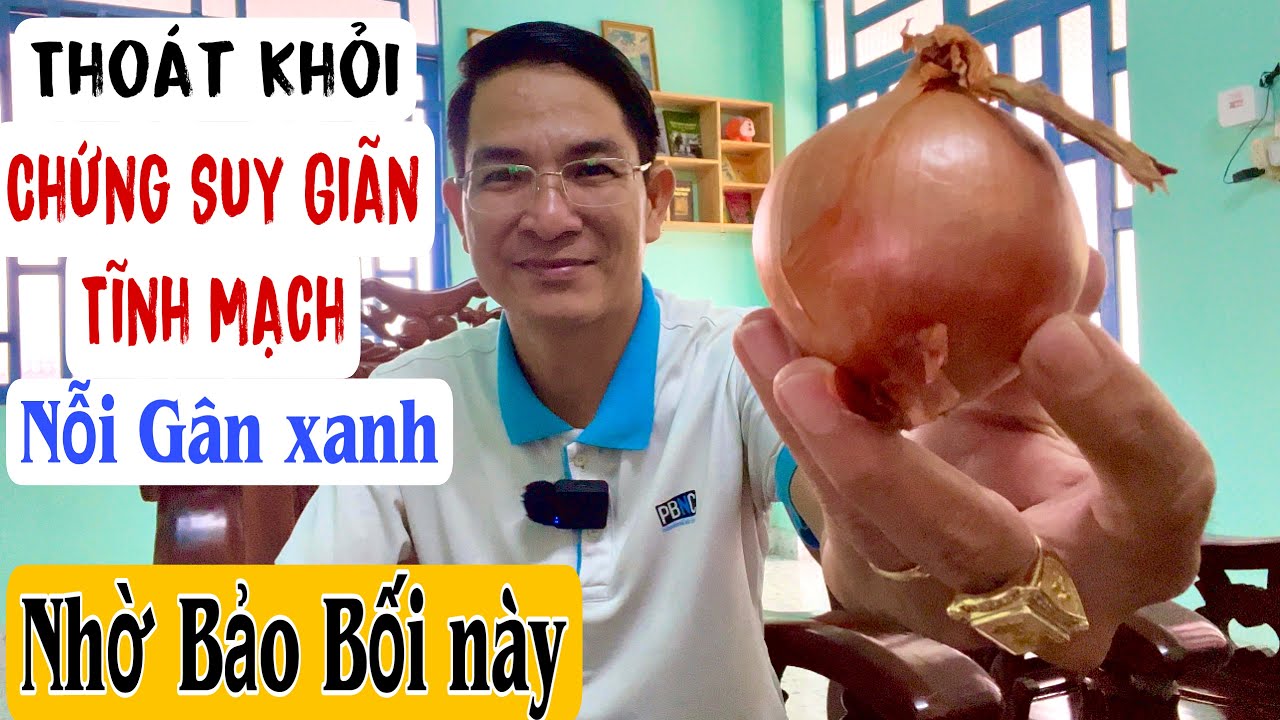 Không thể tin! Thoát khỏi chứng Suy giãn Tĩnh Mạch và nỗi Gân xanh nhờ Bảo Bối này. PHAN HẢI Channel