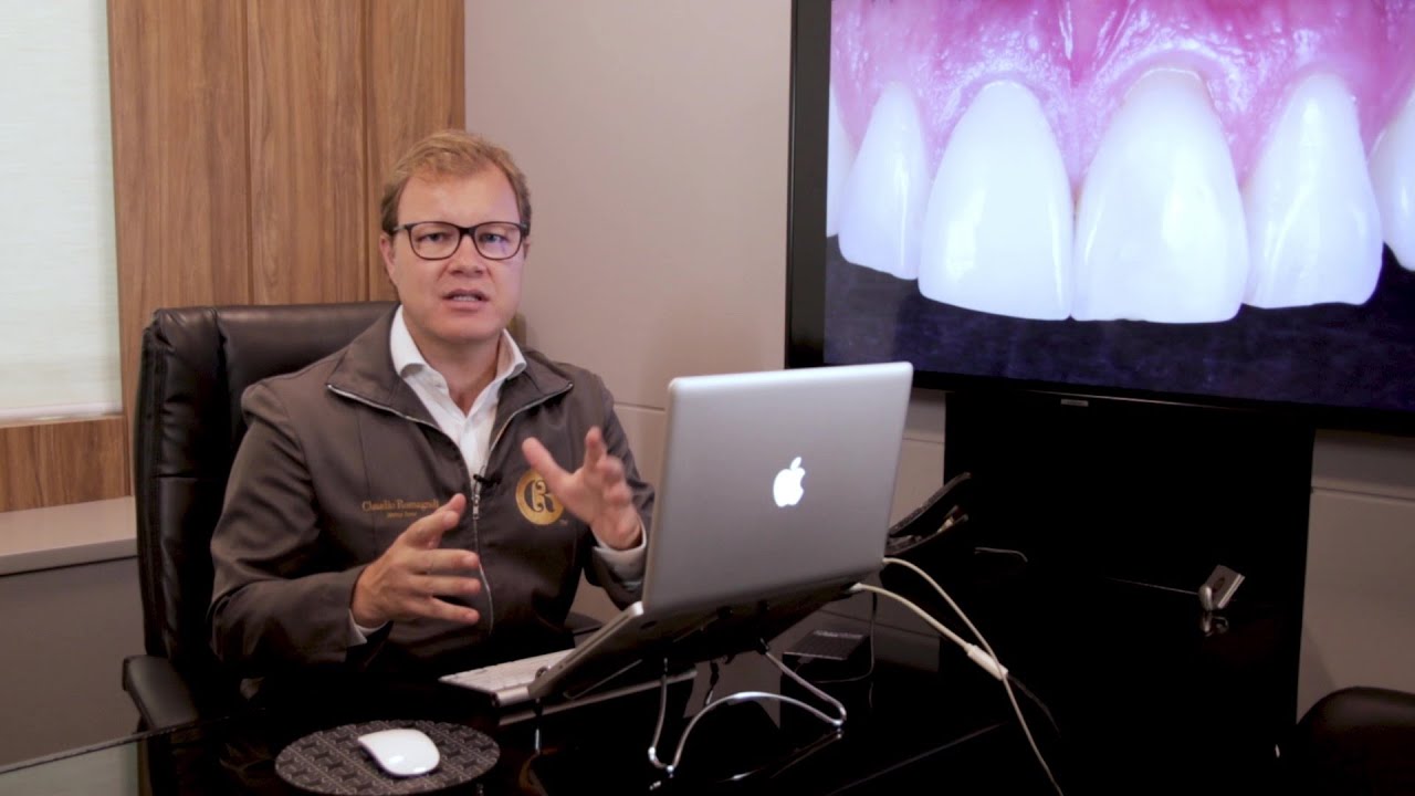 Casos Clínicos: Implante Dental Unitário | Dr. Claudio Romagnoli