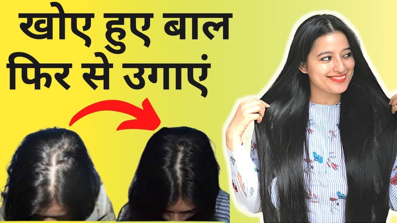 Onion Juice for Hair || Onion से बालों को Grow करें सिर्फ 21 दिनों में इस Natural Remedy से