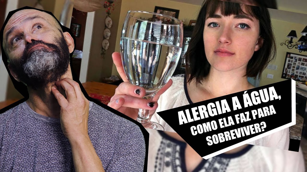 5 PESSOAS QUE POSSUEM ALERGIAS ABSURDAS