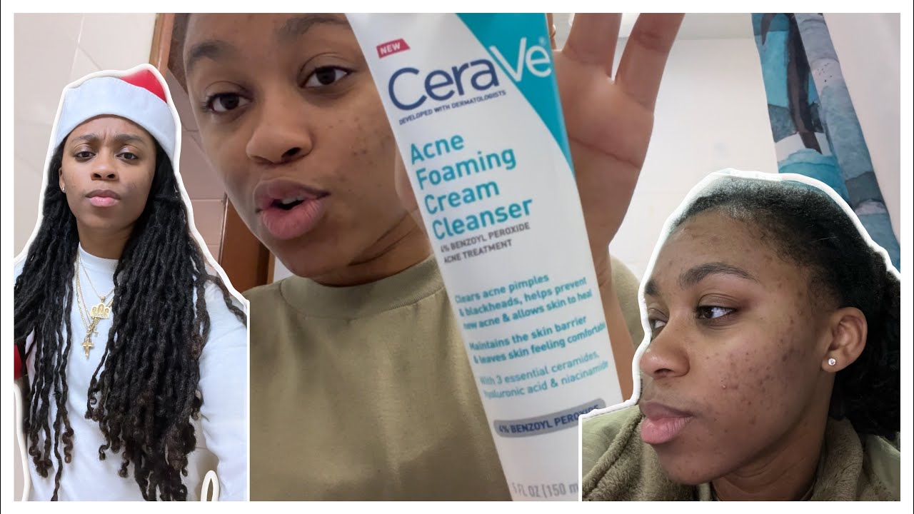 CeraVe Acne Foaming Cream Cleanser Review | Road to Clear Skin | I'm too Old for This!!!!