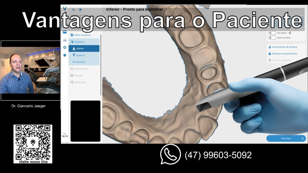 Sorriso Virtual : Descubra o Poder do Escaneamento Intraoral na Estética Dental !