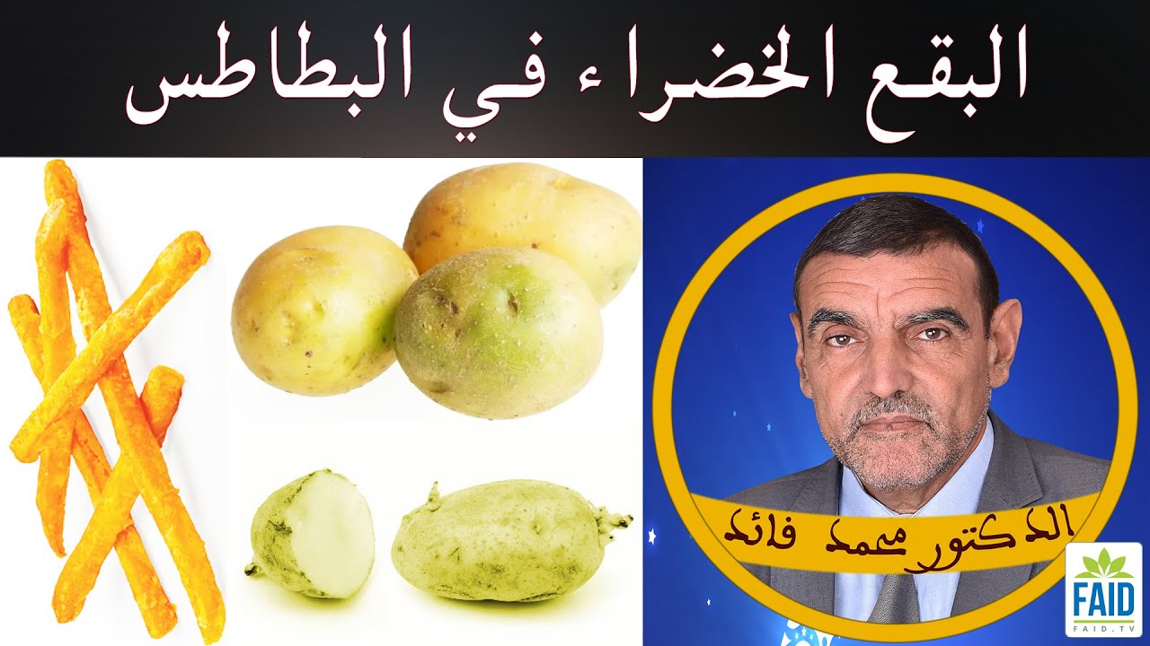 السولانين في البطاطس سامة و تسبب الغثيان والصداع | الدكتور الفايد