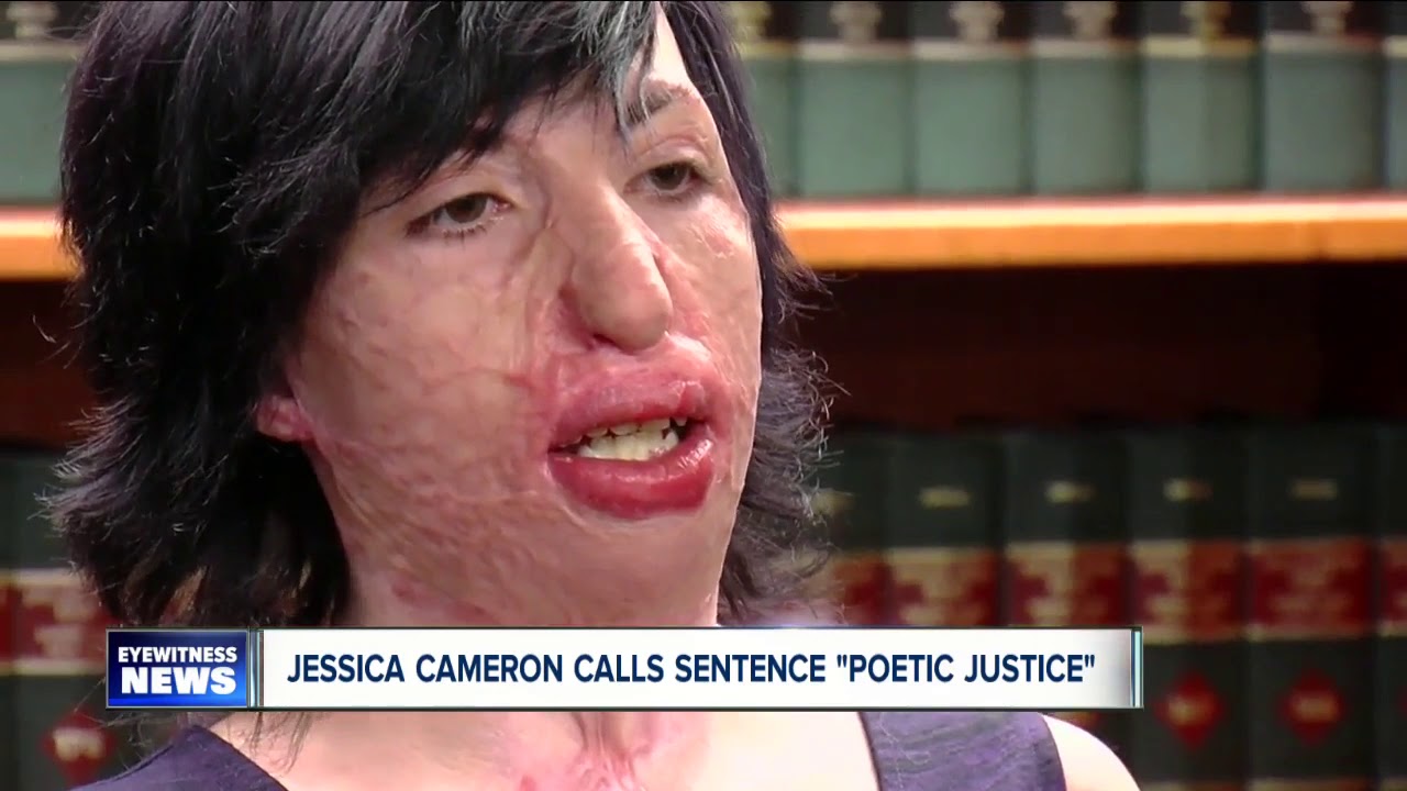 Jessica Cameron bravely speaks in court for the sentencing of the man who set her on fire