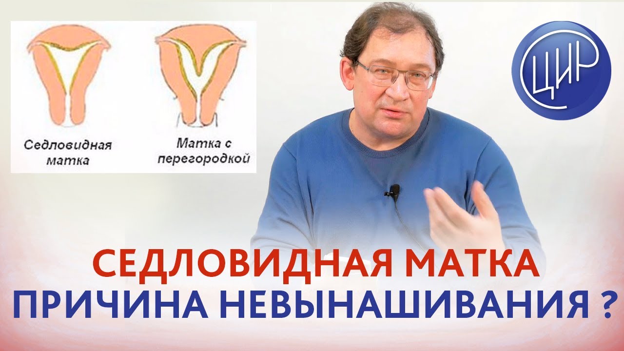 Седловидная матка. Может ли она быть причиной замершей беременности? Т-образная матка и синэстрол.