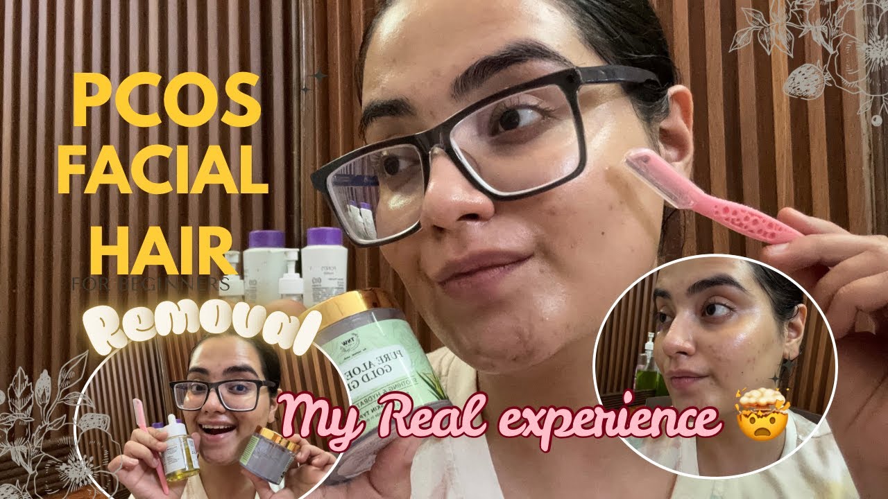 PCOS Facial Hair Removal || my real experience 😱😳 || tips&management !! 
