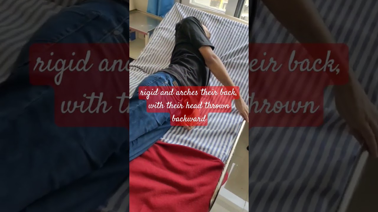 try to get the tetanus booster shot&nbsp;within 48 hours of the injury |opisthotonus position | tetanus