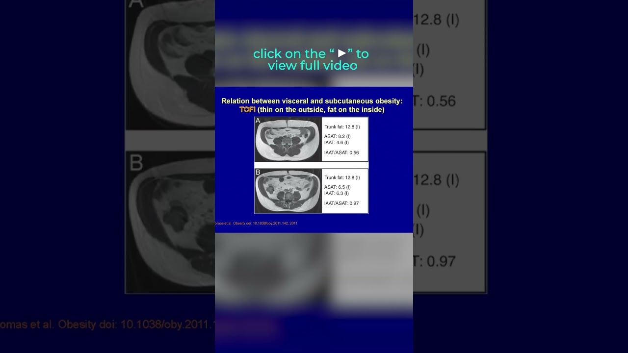 Are you a TOFI (Thin on the outside, fat on the inside) ? Intra-abdominal fat is a danger sign!!