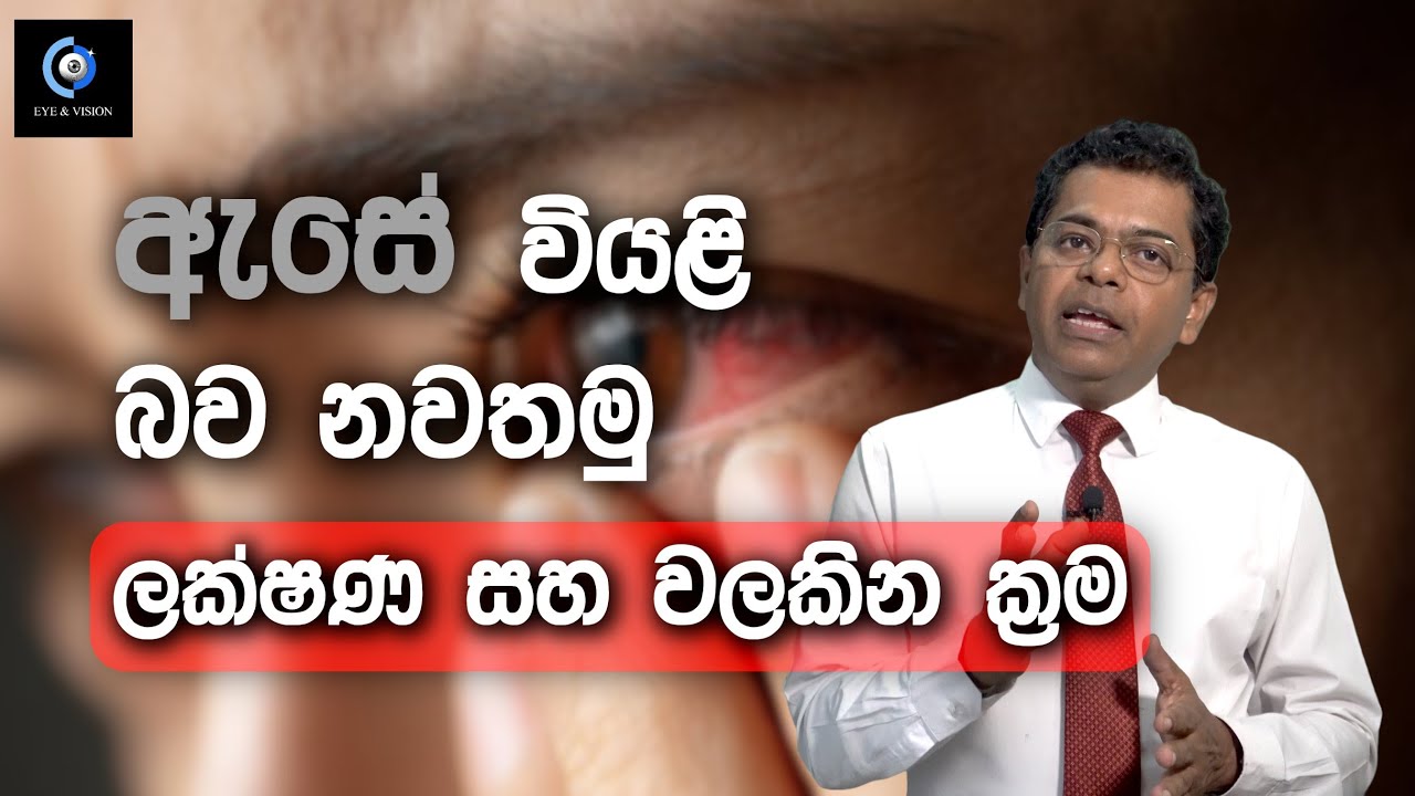 නිතරම ඇස් දැවිල්ල,කඳුළු ගැලීම තියනවද? | Do You Often Have Burning Eyes And Tears?