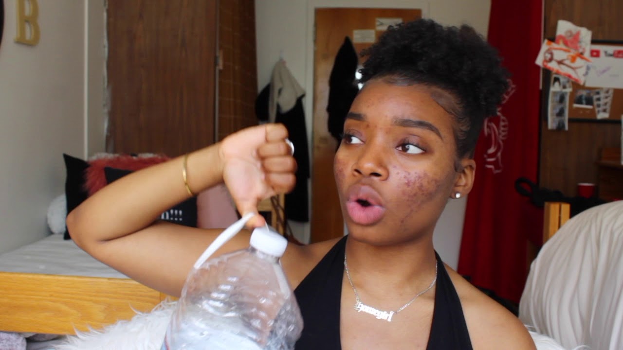4 MONTH Acne journey Update | Going Viral?!