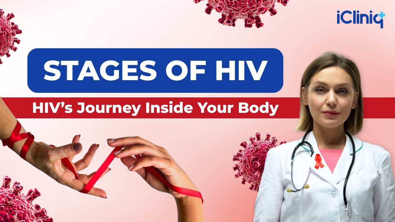 Stages of HIV: What You Need to Know | iCliniq #hiv #hivsymptoms #hivstages #aids