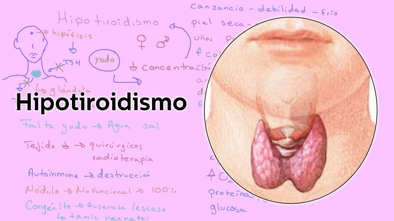 Hipotiroidismo - Salud - Educatina