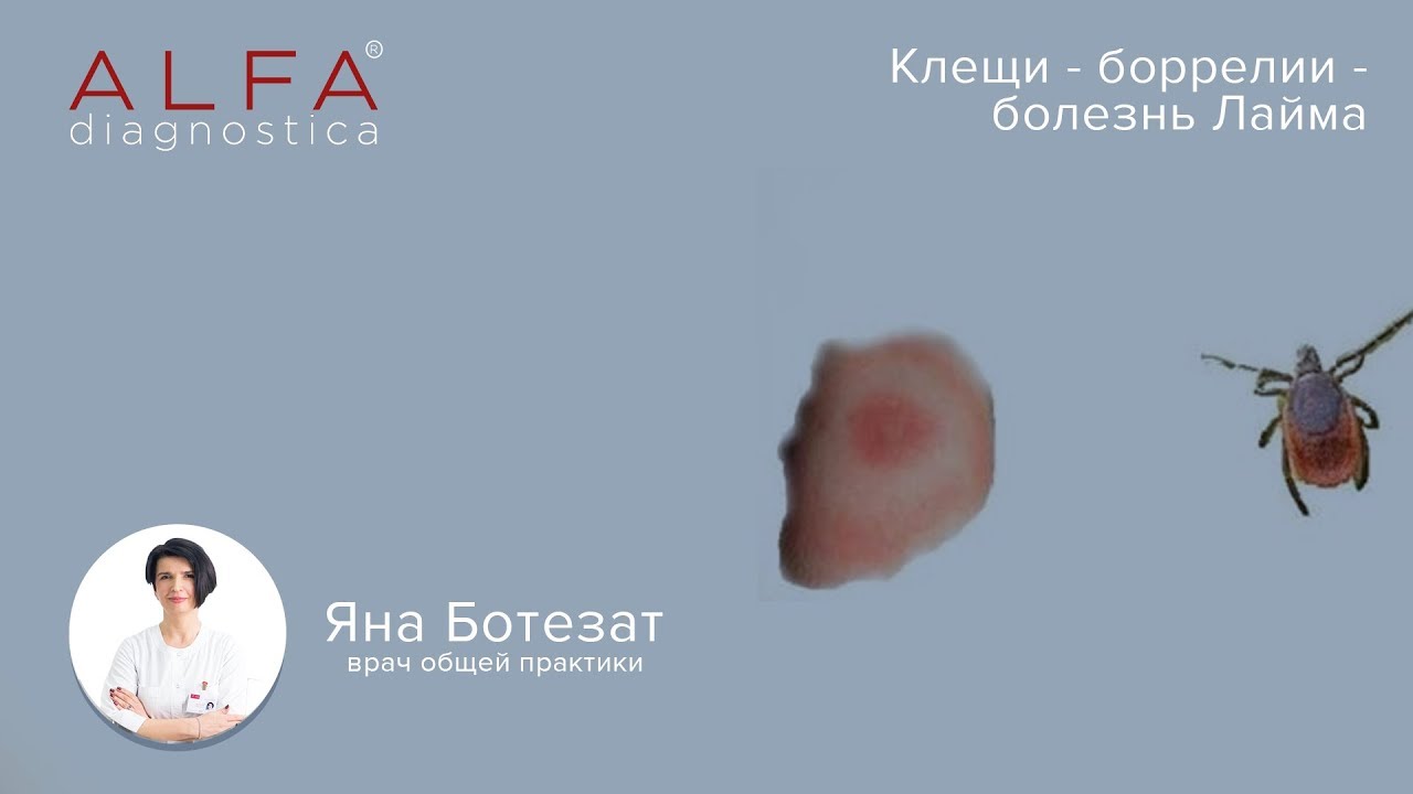 [AlfaMedBlog] 14: Клещи - боррелии - болезнь Лайма