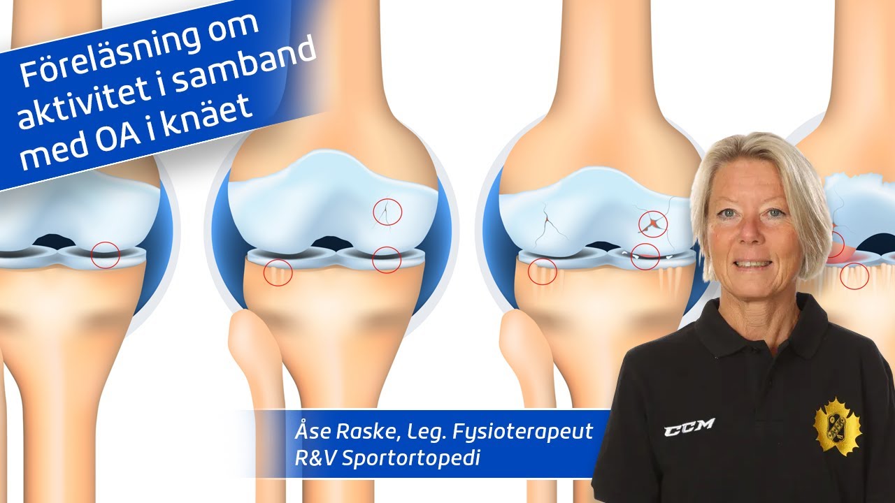 Aktivitet vid OA av Åse Raske