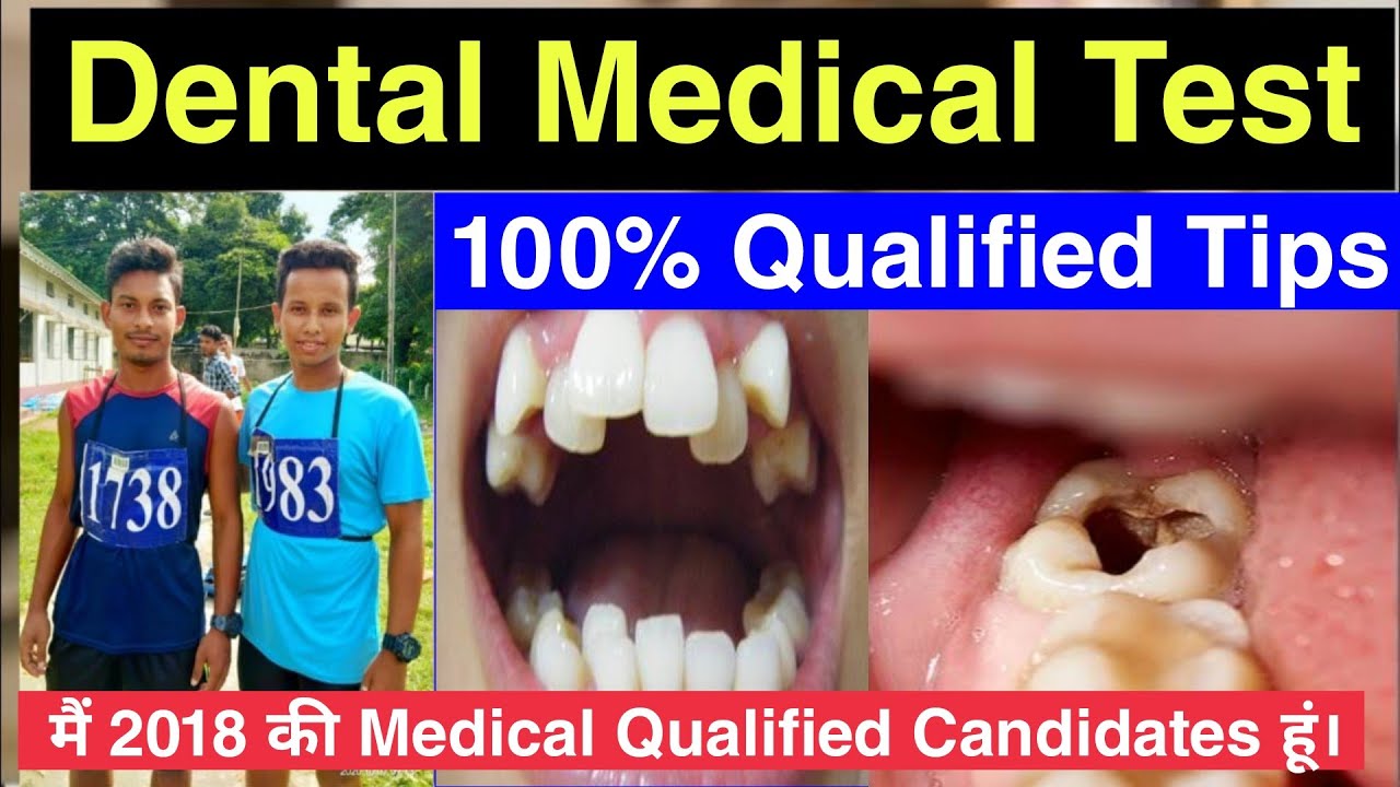 Dental Medical Test Check || SSC-GD Dental Medical Test || Indian Army Dental Medical Test