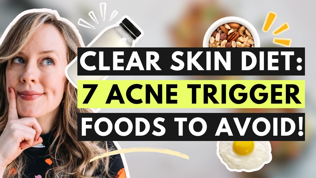 Диета для чистой кожи: основные продукты, провоцирующие появление прыщей, которых следует избегать!
