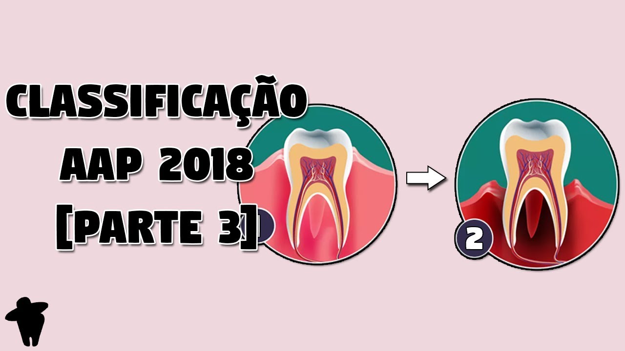 [Parte 3] Classificação das Doenças Periodontais e Peri-Implantares 2018 -  AAP 2018