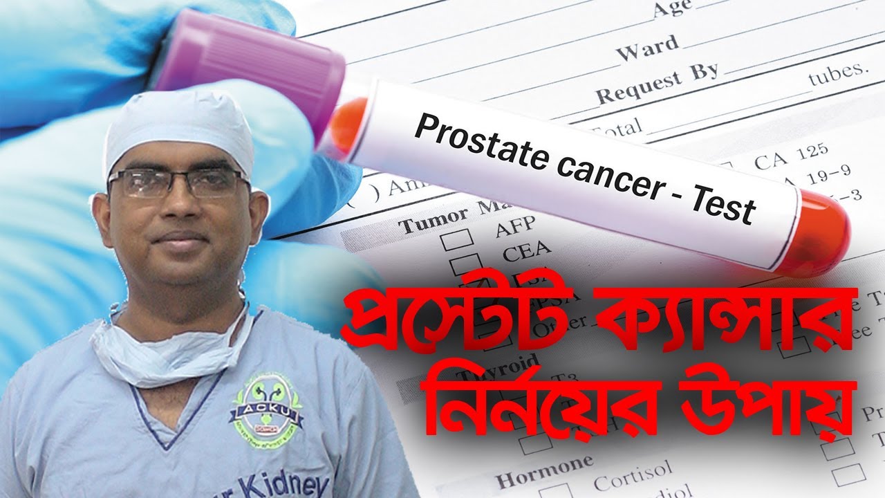 Prostate Specific Antigen (PSA) Test । Dr. Fazal Naser। হাসপাতাল